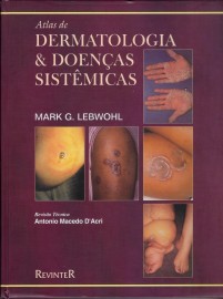 Atlas Dermatologia E Doencas Sistemicas -01ed/2000 [Paperback] Lebwohl, Mark G.