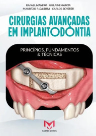 Cirurgias Avan�adas Em Implantodontia - Princ�pios, Fundamentos E T�cnicas