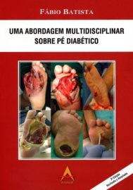 Uma Abordagem Multidisciplinar Sobre Pé Diabético - Fabio Batista 8560416609 