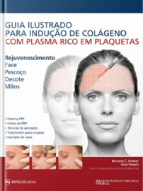 Guia Ilustrado Para Indu��o De Col�geno Com Plasma Rico Em Plaquetas [Hardcover] BERNARD C. KOLSTER, UWE PAASCH