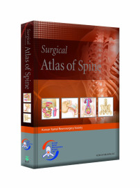 Surgical Atlas of Spine - Atlas Cir�rgico da Coluna Vertebral 