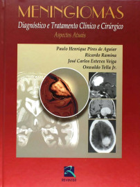 Livro - Meningiomas