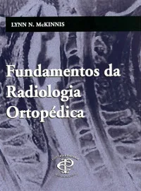 Fundamentos da Radiologia Ortop�dica  1 Janeiro 2004 por Lynn N. Mckinnis - 8586067326