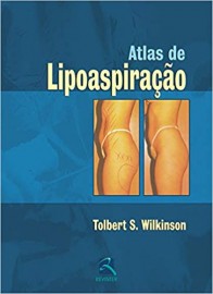 Livro Atlas de Lipoaspirao - Tolbert S. Wilkinson