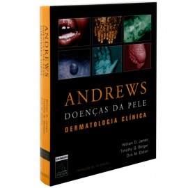 Livro  Andrews  Doenças da Pele  Dermatologia Clínica