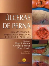Preven��o e Tratamento de �lceras de Press�o (Portugu�s) por Moya J. Morison 9898075252